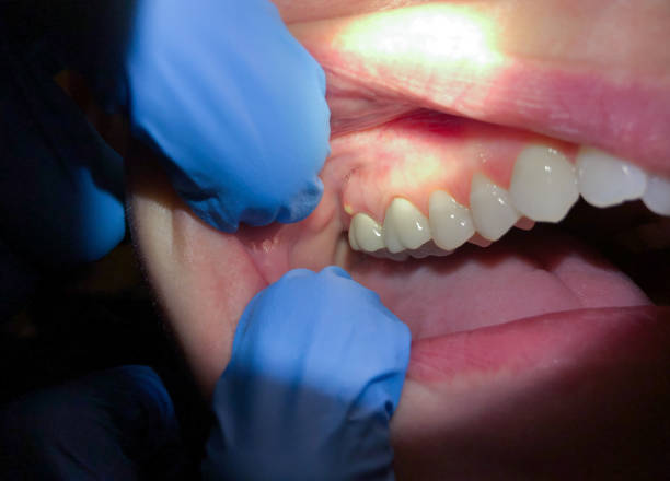 Best Emergency TMJ Treatment in Union City, PA