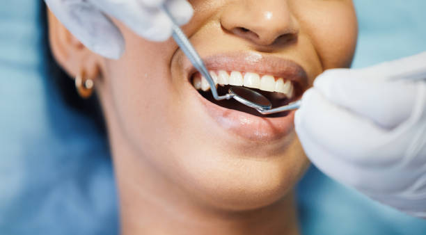 Best Emergency Tooth Extraction in Union City, PA